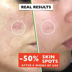 Big 2.11Oz. Organic Vitamin C Serum for Face. Anti-Dark Spots, Wrinkles Skin Repair Serum with Hyaluronic Acid, Vitamin C & Niacinamide. All-In-One Brightening, anti Aging Facial & Eye Area Skincare